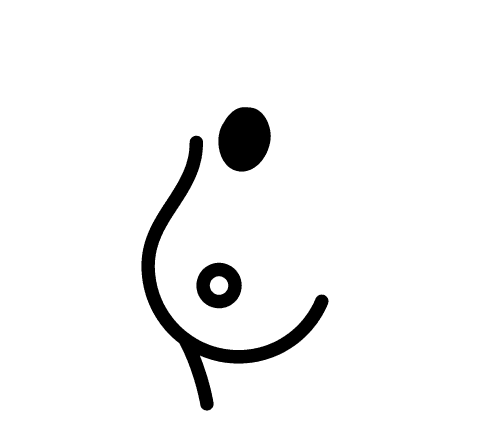 Erblicher Brust und Eierstock Krebs