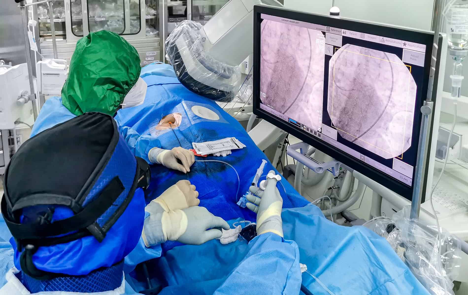 interventionelle-radiologie-minimalinvasive-verfahren-bildgebung-einsatz-vorteile