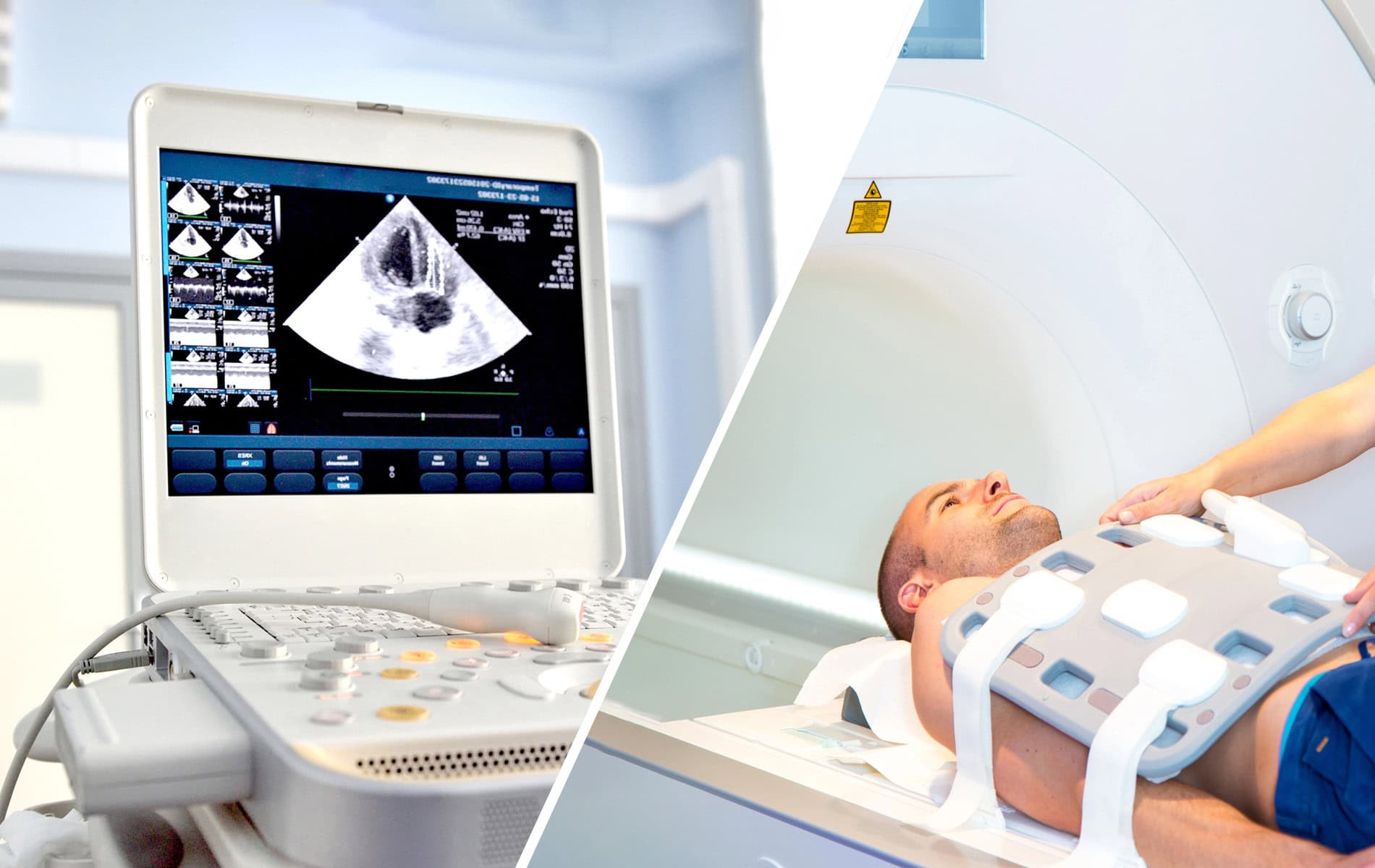 herzinfarkt-notfalldiagnostik