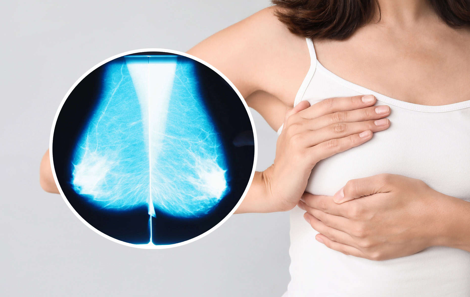 unklare-knoten-brust-abklaeren