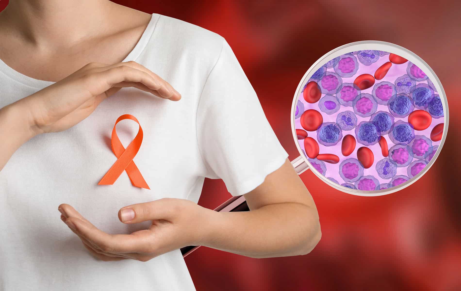 leukaemie-(blutkrebs)